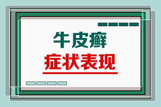 红皮型牛皮癣患者的病情变得越来越严重是什么原因导致的呢