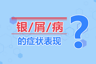 青少年牛皮癣不治的后果很严重！看完这些你就不会忽视孩子的治疗了