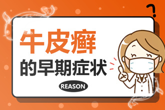 牛皮癣 了还会遗传给下一代吗-遗传几率会变低吗？